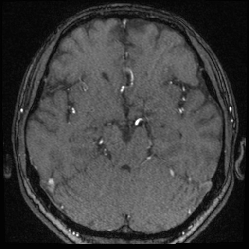 Click on the Serie image to view the images of VILLANUEVA, WILLIAM A.